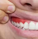Cause gum irritation or soreness